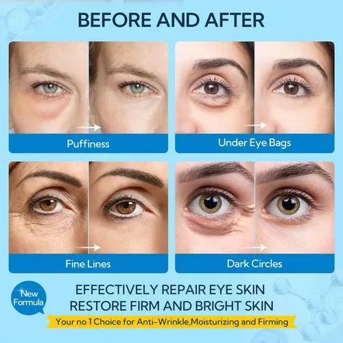 I/l Mascarilla Para Ojos Con Ácido Hialurónico Bioaqua 80