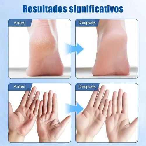 Exfoliante De Pies Hidratante Para Callos Y Durezas