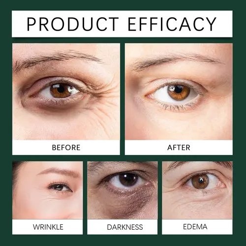 Sérum De Ojos Ouhoe Mint Eye Roller Para Líneas Finas E Hidr