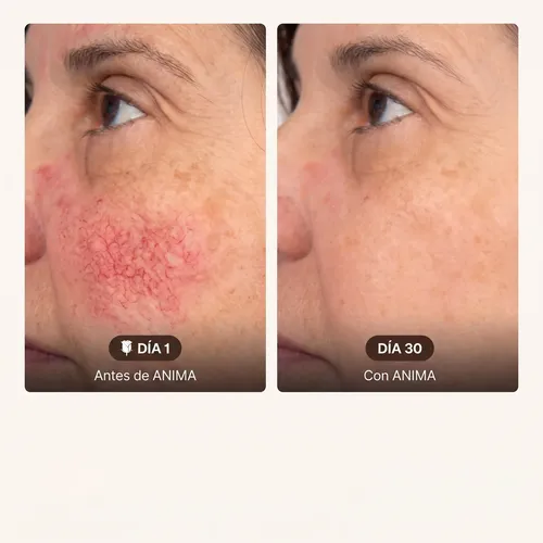 Anima Crema Natural Correctora Rosácea Y Acné 110g