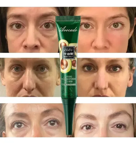 Crema Antiarrugas Antiarrugas De 7 Días Para Ojos Oscuroser