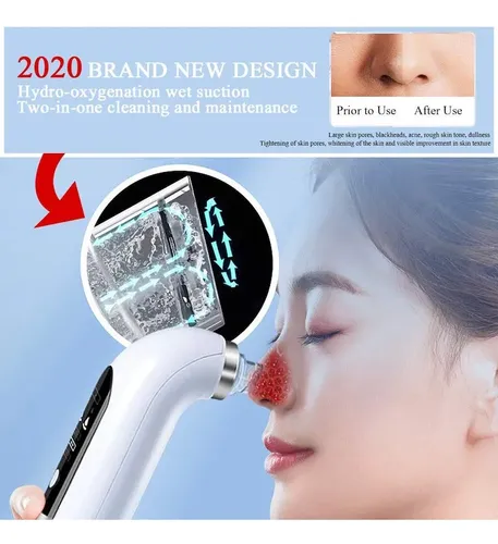 Removedor Eléctrico Pequeño Negro Para Espinillas Beauty
