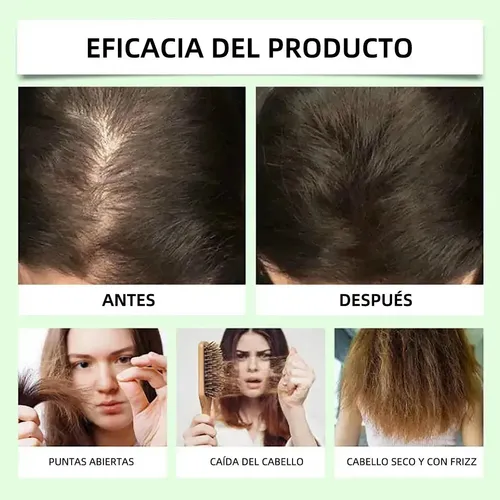 Lc Champú Anticaída Del Cabello Remimpi  300ml