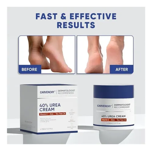 Gx2crema Hidratante Urea Ácido Salicílico 150g