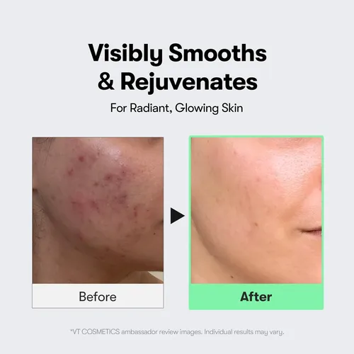 Esencia Facial Iluminadora Cuidado Piel 50 Ml Todo Tipo De Piel Día/noche