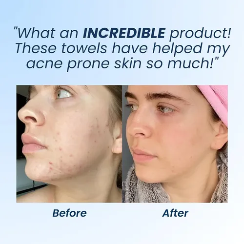 50 Unidades/caja Clean Towels, Toalla Facial Desechable Ii