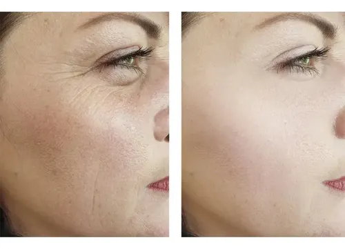 Ampolletas Retinol Antiarrugas Antimanchas Aclarante Cj 30pz Momento De Aplicación Noche Tipo De Piel Todo Tipo De Piel