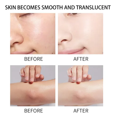 Spray Exfoliante De Cúrcuma Para El Cuidado Corporal De Quer