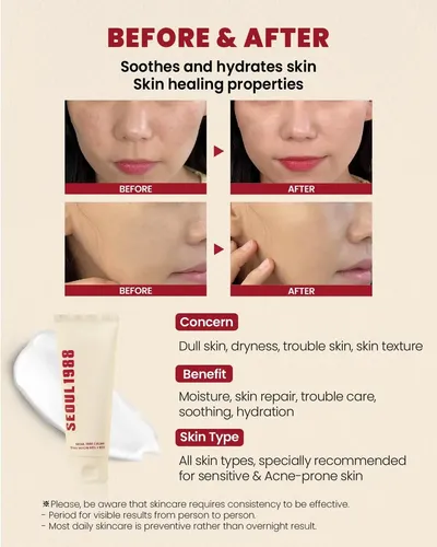 Crema Mucina De Caracol 93% Hidratante Facial