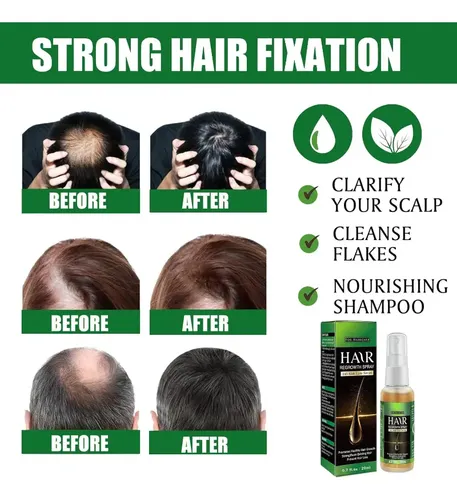 W El Sérum Para El Crecimiento Del Cabello Promueve El W