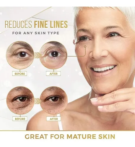 Parche Ocular De Ácido Hialurónico (elimina Ojeras, Bolsas E