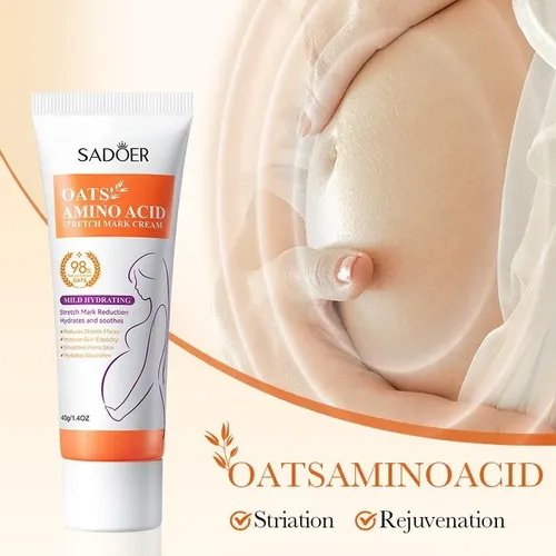 Crema Corporal Suave Reduce Estrías, Mejora Elasticidad
