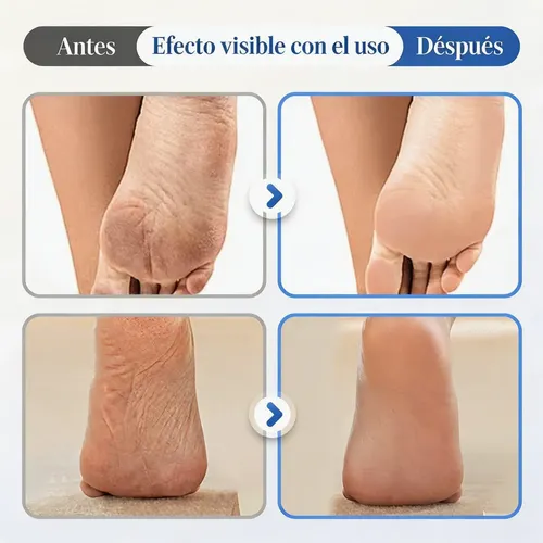 Crema For Pies Hidratante Y Antigrietas Con Urea Al 60%,