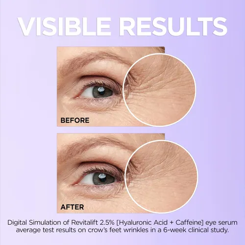 Sérum Para Ojos L’oreal Paris Revitalift Con Ácido Hialuróni Todo Tipo De Piel Día/noche