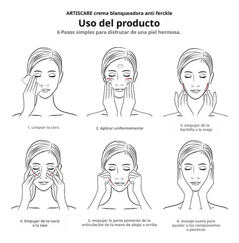 Crema Blanqueadora Para Manchas Oscuras, Antipecas,