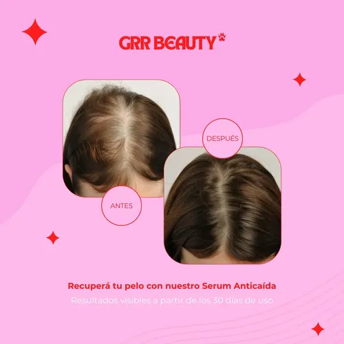 Serum Anticaida – Grr Beauty