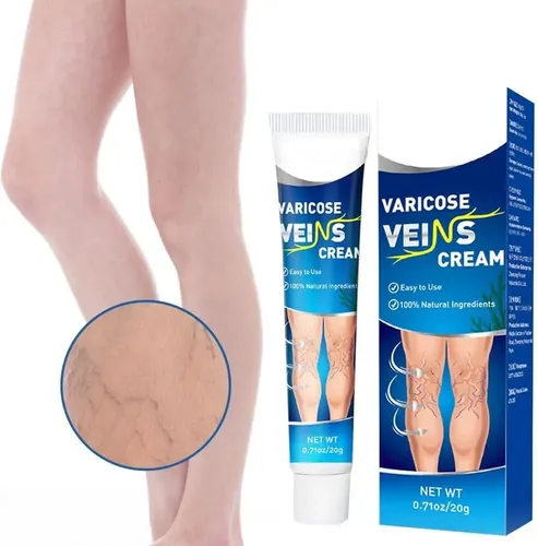 Crema Para Alivio De Varices Piernas Varicosas