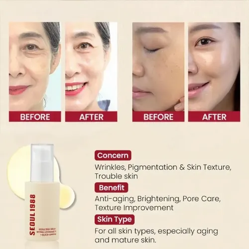 Serum Reparador + Crema De Ojos Seoul1988 Antiedad Todo