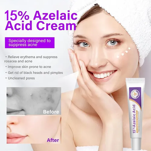 Crema Ácida: Crema Facial Hidratante Y No Pegajosa Para Una