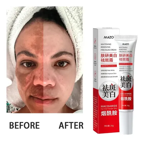 Crema Mazo Despigmentante Y Blanqueadora 20g Todo Tipo De Piel Día/noche