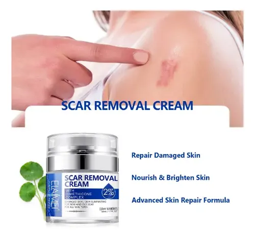 Crema Reparadora Eliminadora De Cicatrices – Pomada Cicatriz