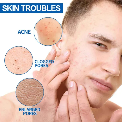 Crema Facial Multiefecto Para Hombres Que Limpia Los Poros Y