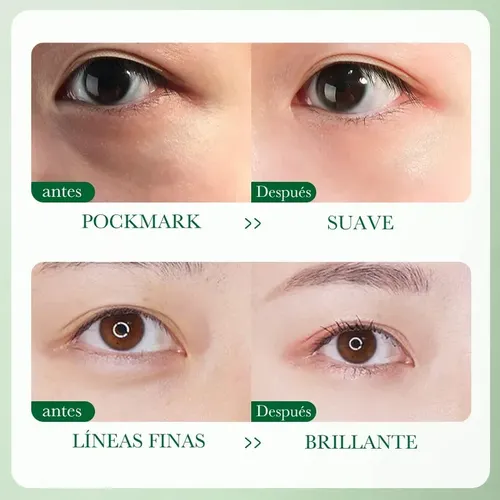 Contorno Para Ojos Hidratante Centella Asiatica 20g Todo Tipo De Piel Día/noche