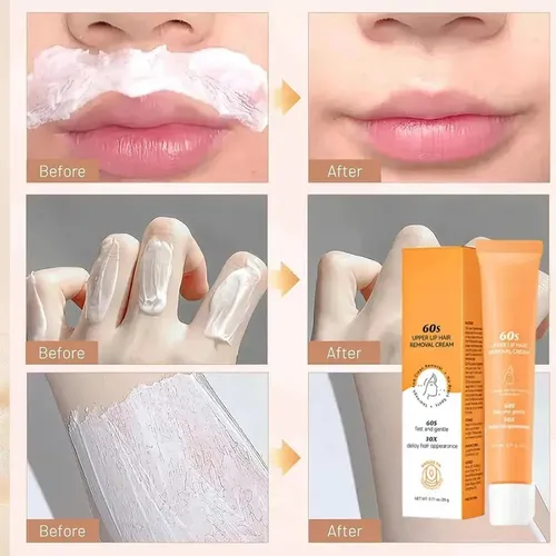 New 2026- Depilación Del Labio Superior, Suave, */rgh