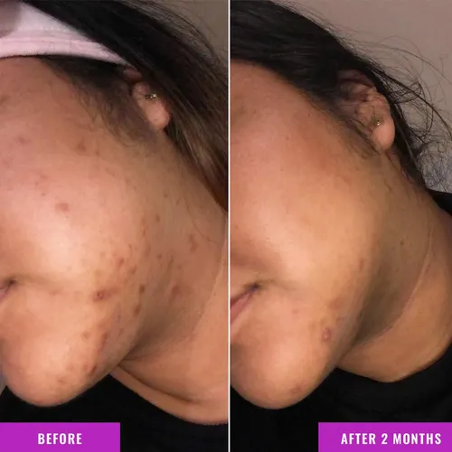 Suero Corrector De Despigmentación Good Molecules 30ml/30g