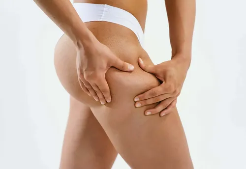 Crema Reductora Corporal Abdomen Cintura Muslos Y Caderas