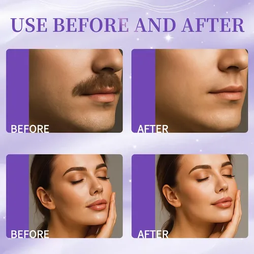 Tiras De Cera Facial Plongtui 40 Tiras Y 4 Toallitas De Acei