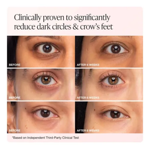 Creme De Olhos Innbeauty Project Bright & Tight Con Vitamina