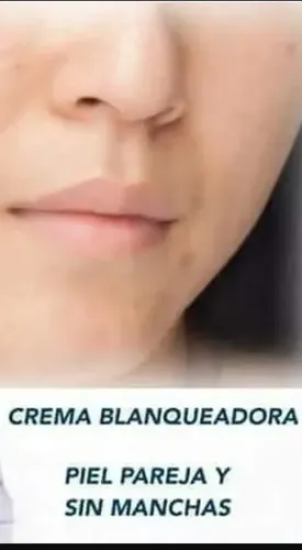 Just Crema Blanqueadora Jackfruit – Elimina Manchas Aclara Tipo De Piel Todo Tipo De Piel