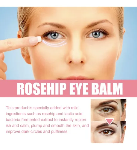 = Bálsamo De Ojos De Rosa Mosqueta 3g – Anti-ojeras Y -/
