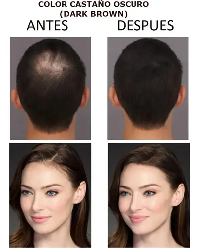 Fibras Capilares Vangin Castaño Claro Beauty Choice 27,5g Calvicie Grosor