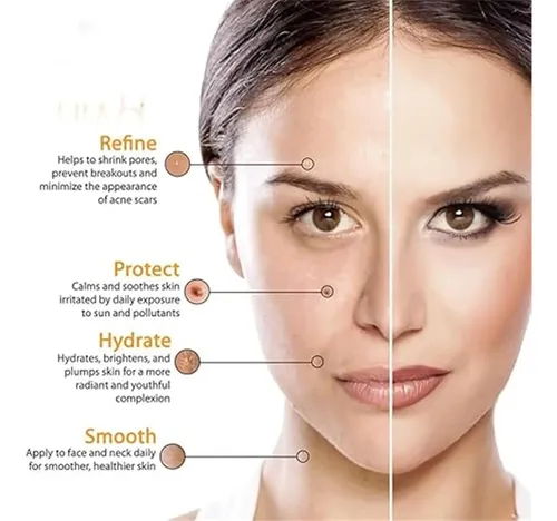 Bnn Crema Facial Con Vitamina C Carvenchyb