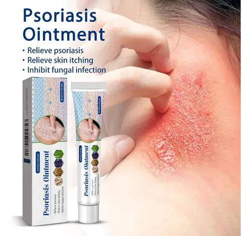 Crema Antimicótica Para La Tiña Inguinal