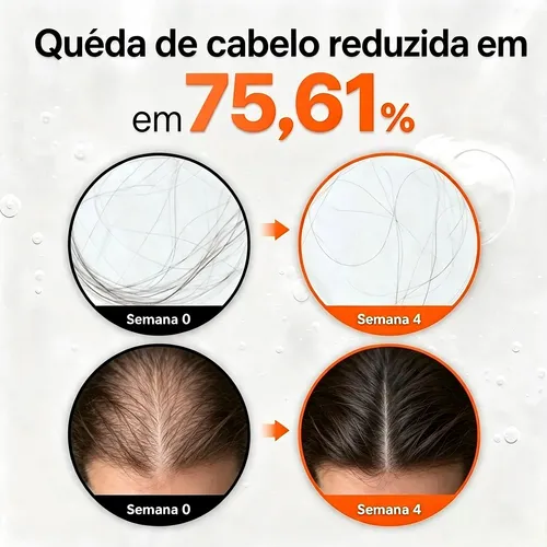 Sérum Crecimiento Capilar Lilyeve Con Aplicador