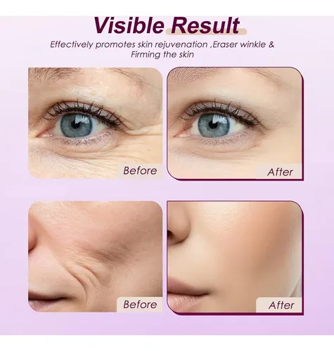 Set Anti-edad Con Suero Rosa Y Parches Para Ojos