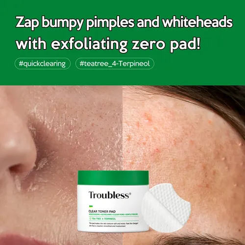 Almohadilla De Tóner Trouless Clear Face 60 Pastillas Tea Tr