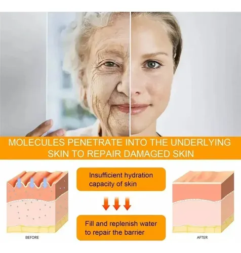 Crema Reafirmante Para Ojos, Elimina Bolsas Y Ojeras.