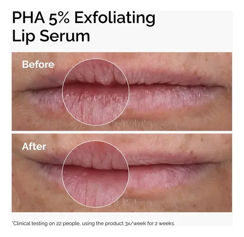 PHA 5% Exfoliating Lip Serum The Ordinary tratamiento exfoliante e hidratante para labios 15mL