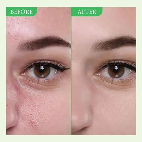 Mascarilla De Arcilla De Tomate Verde Para Piel