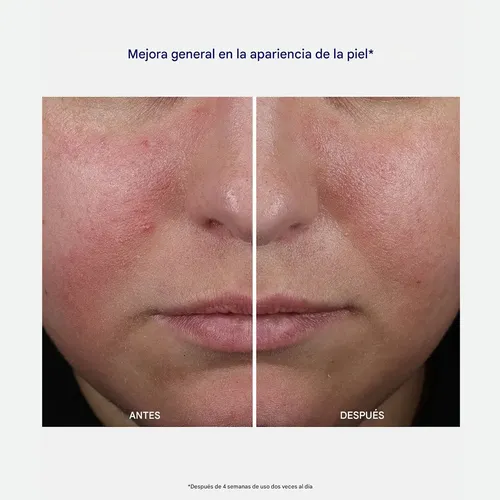 Neostrata Clarify Mandelic Clarifying Hydragel Antiacné Acneica Día/noche