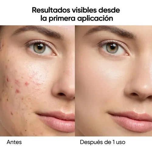 /skintific Mascarilla Mugwort En Barra Limpieza Profunda/.