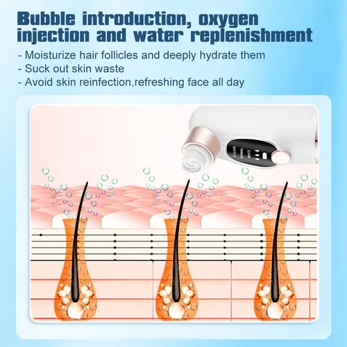 Limpiador Eléctrico Pore Vacuum Face Blackhead Ii
