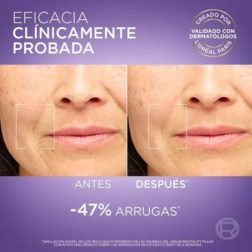 Sérum Rostro Revitalift Ácido Hialurónico L’Oréal Paris 30ml