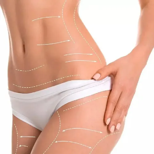 Prodermic Lipo Biomar Celulitis Maceracion De Algas X 130ml.