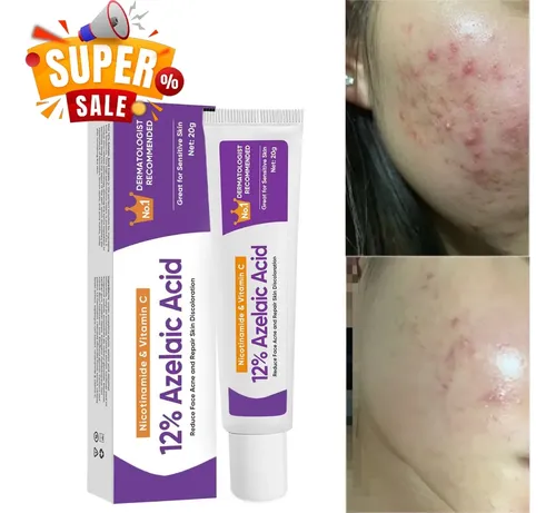 Crema Facial Ácido Azelaico 12% 20g Para Acné Y Manchas Todo Tipo De Piel Día/noche