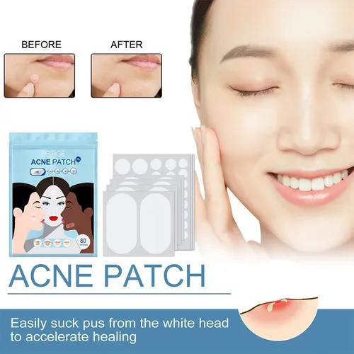 Patch Ii Pimple Acne De Tamaño Grande, 80 Unidades/juego